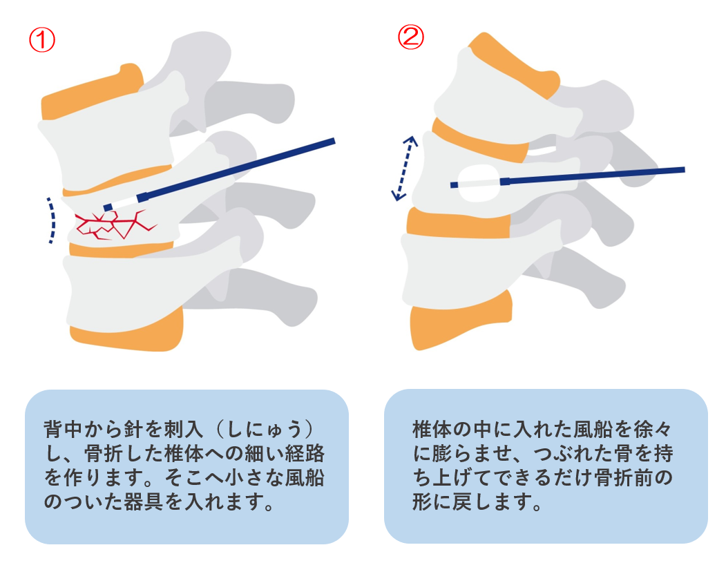 BKP手術1・2 | 社会医療法人愛仁会 【井上病院】